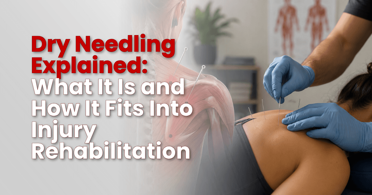 Dry Needling Explained: What It Is and How It Fits Into Injury Rehabilitation