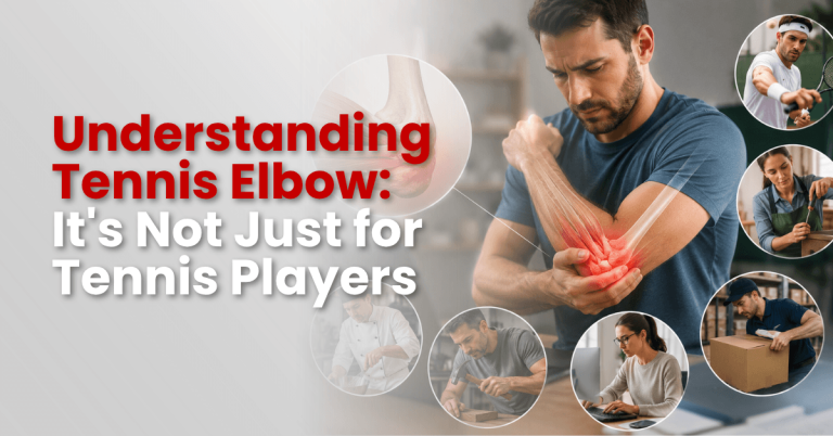 Understanding Tennis Elbow: It’s Not Just for Tennis Players